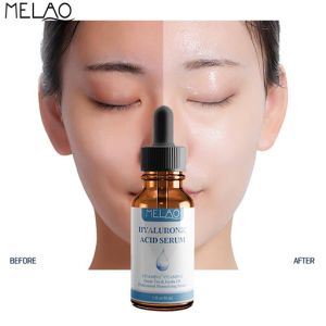 Melao Hyaluronic Acid Serum:-30 ml